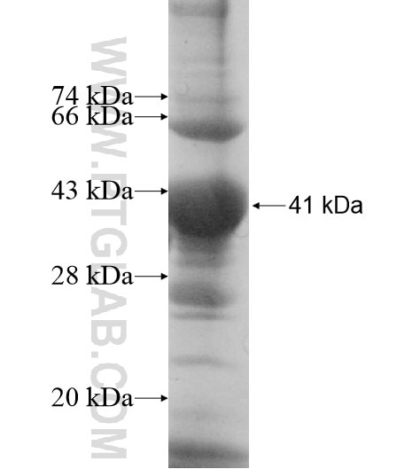 GIMAP7 fusion protein Ag10740 SDS-PAGE
