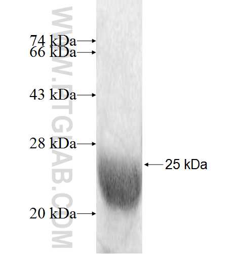 GINS1 fusion protein Ag9192 SDS-PAGE