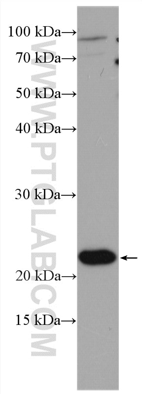 Western Blot (WB) analysis of Jurkat cells using PSF2 Polyclonal antibody (16247-1-AP)