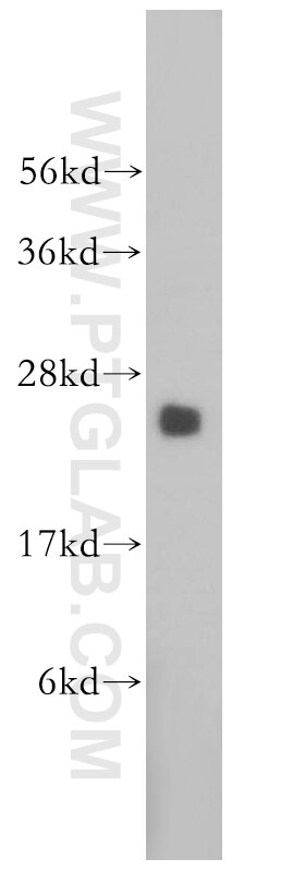 Western Blot (WB) analysis of HeLa cells using PSF2 Polyclonal antibody (16247-1-AP)