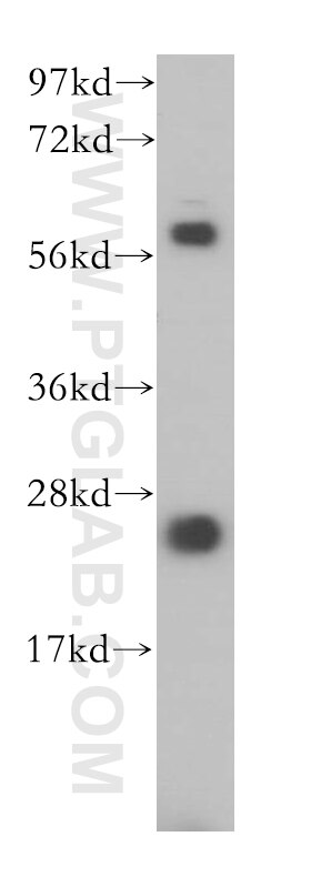 Western Blot (WB) analysis of HepG2 cells using PSF2 Polyclonal antibody (16247-1-AP)