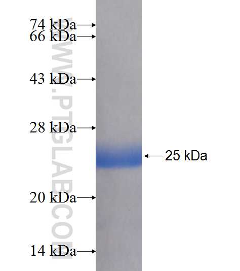 GINS2 fusion protein Ag9163 SDS-PAGE