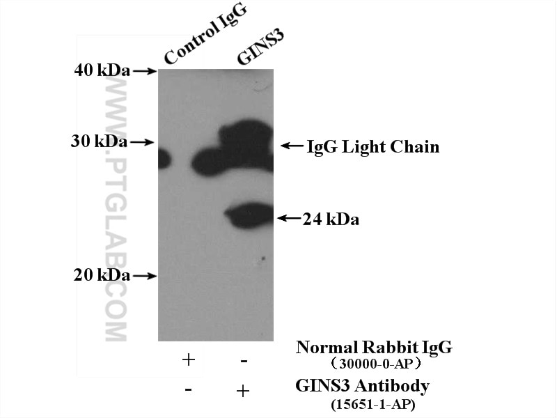 Immunoprecipitation (IP) experiment of Jurkat cells using GINS3 Polyclonal antibody (15651-1-AP)