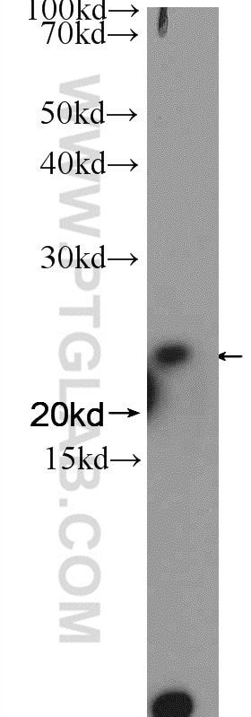 Western Blot (WB) analysis of NIH/3T3 cells using GINS3 Polyclonal antibody (15651-1-AP)