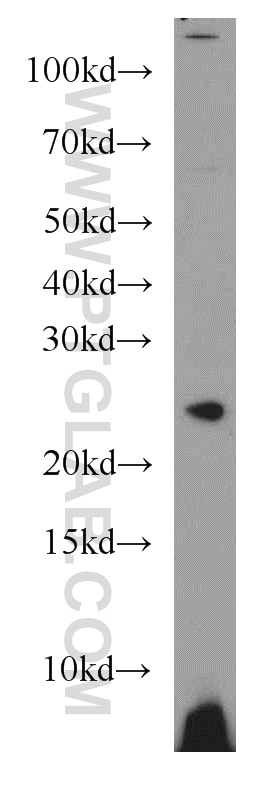 Western Blot (WB) analysis of Jurkat cells using GINS3 Polyclonal antibody (15651-1-AP)