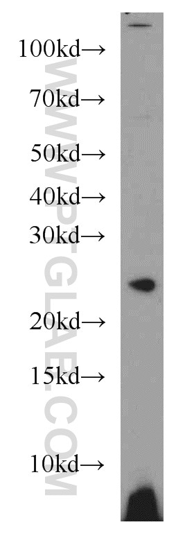 WB analysis of Jurkat using 15651-1-AP