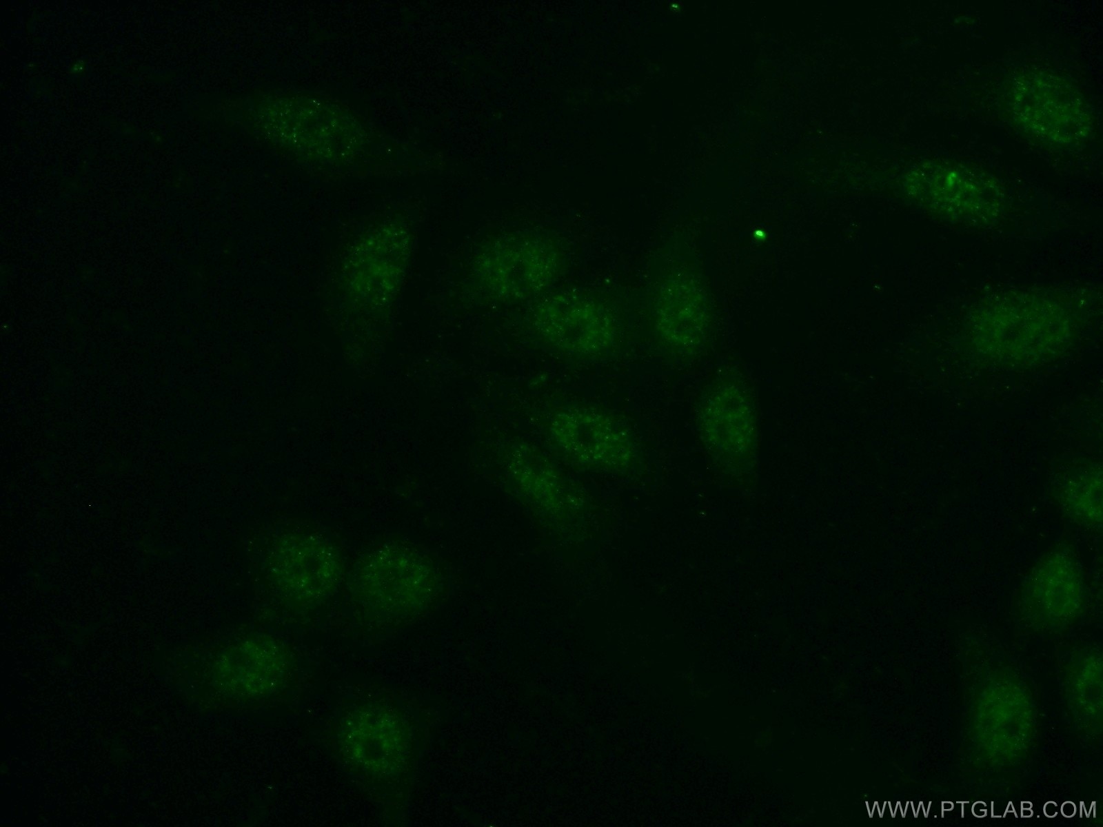 Immunofluorescence (IF) / fluorescent staining of HeLa cells using PSF3 Polyclonal antibody (16345-1-AP)