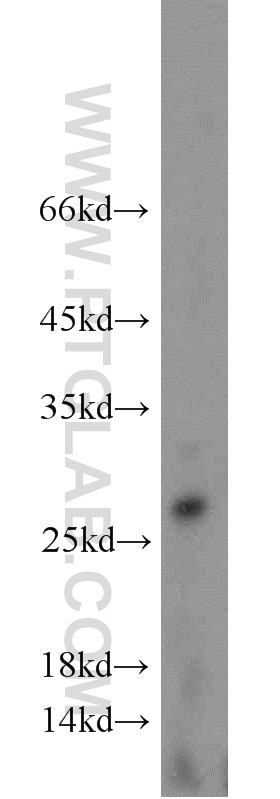 Western Blot (WB) analysis of MCF-7 cells using PSF3 Polyclonal antibody (16345-1-AP)
