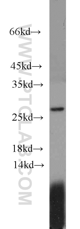 Western Blot (WB) analysis of MCF-7 cells using PSF3 Polyclonal antibody (16345-1-AP)