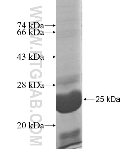 GINS3 fusion protein Ag11102 SDS-PAGE