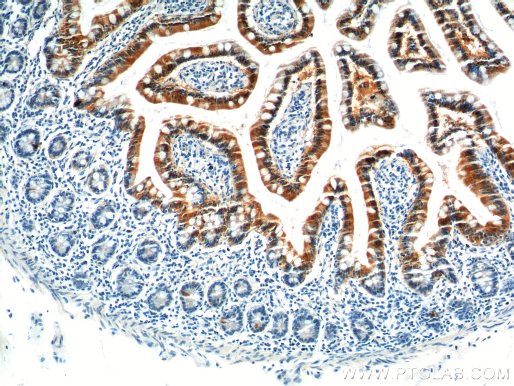 Immunohistochemistry (IHC) staining of human small intestine tissue using GIP Polyclonal antibody (18034-1-AP)