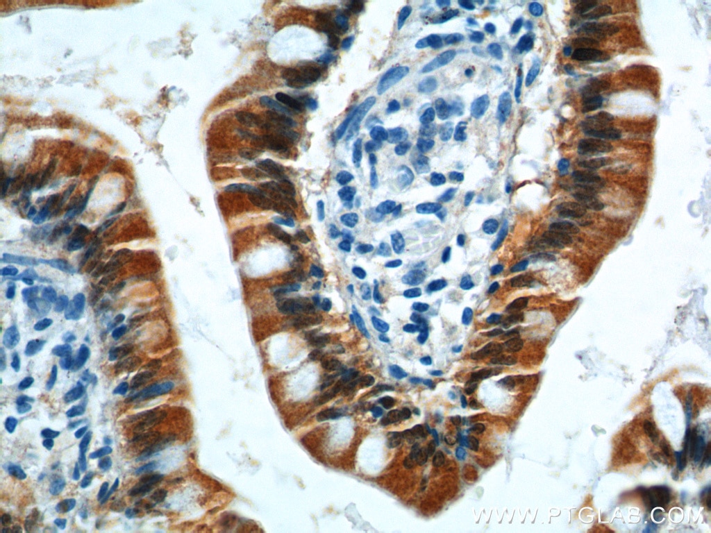 Immunohistochemistry (IHC) staining of human small intestine tissue using GIP Polyclonal antibody (18034-1-AP)