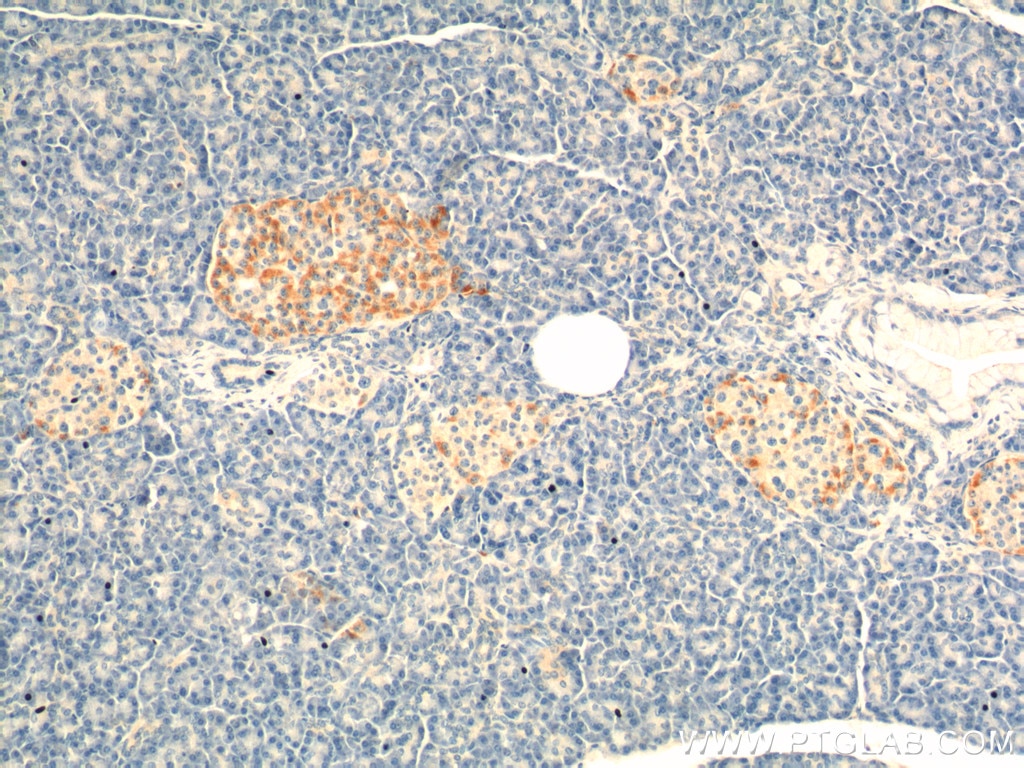 Immunohistochemistry (IHC) staining of human pancreas tissue using GIP Polyclonal antibody (18034-1-AP)