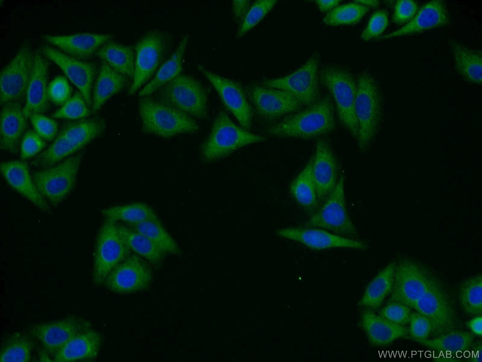 Immunofluorescence (IF) / fluorescent staining of HepG2 cells using GIPC1 Polyclonal antibody (14822-1-AP)