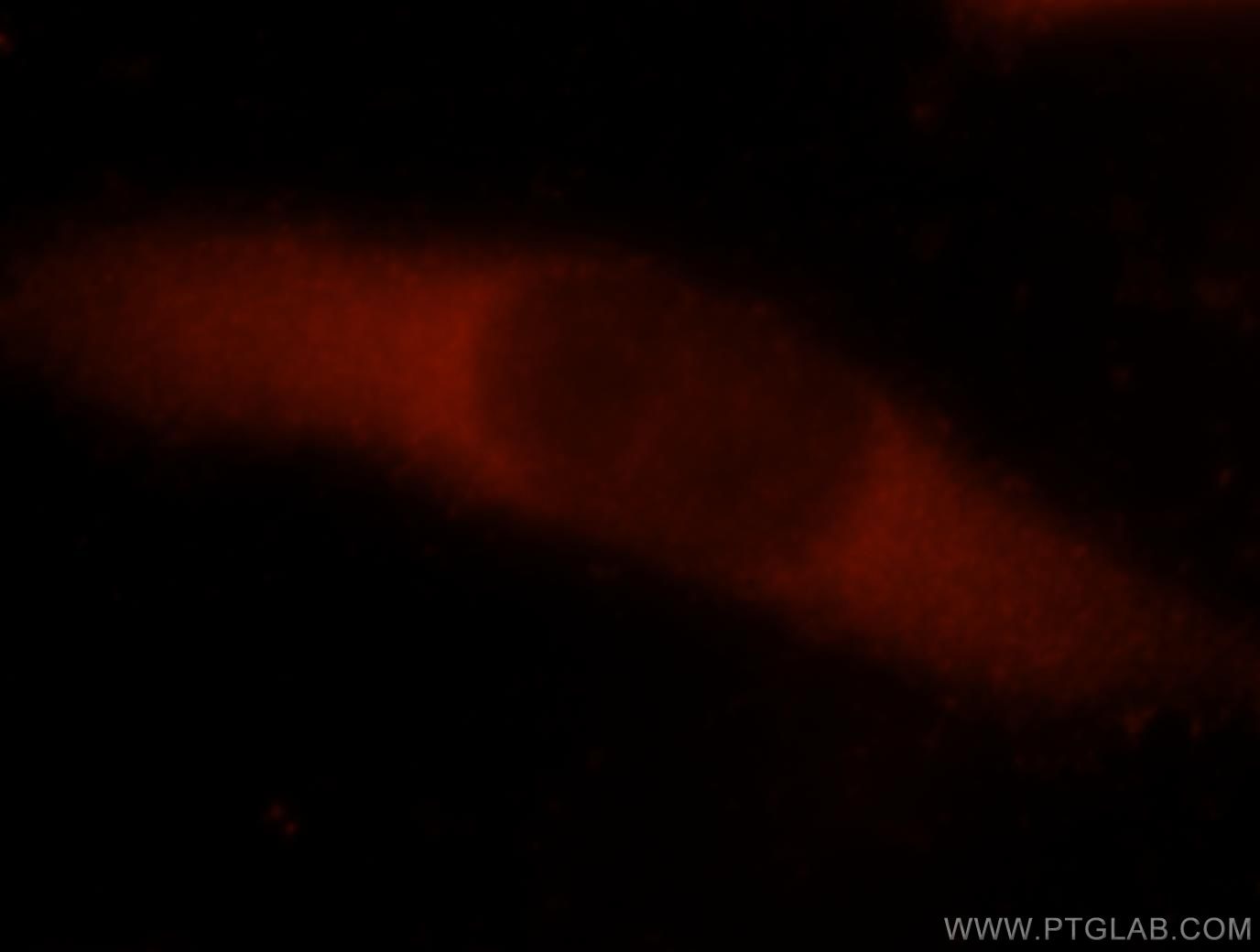 Immunofluorescence (IF) / fluorescent staining of A2780 cells using GIPC1 Polyclonal antibody (14822-1-AP)