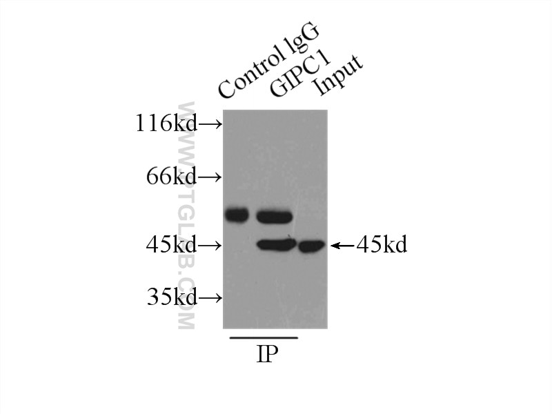 Immunoprecipitation (IP) experiment of mouse brain tissue using GIPC1 Polyclonal antibody (14822-1-AP)