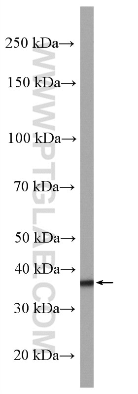 Western Blot (WB) analysis of mouse skeletal muscle tissue using GIPC1 Polyclonal antibody (14822-1-AP)