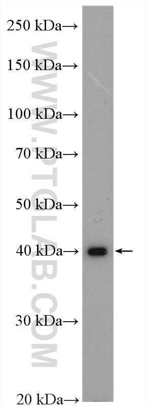 Western Blot (WB) analysis of HepG2 cells using GIPC1 Polyclonal antibody (14822-1-AP)