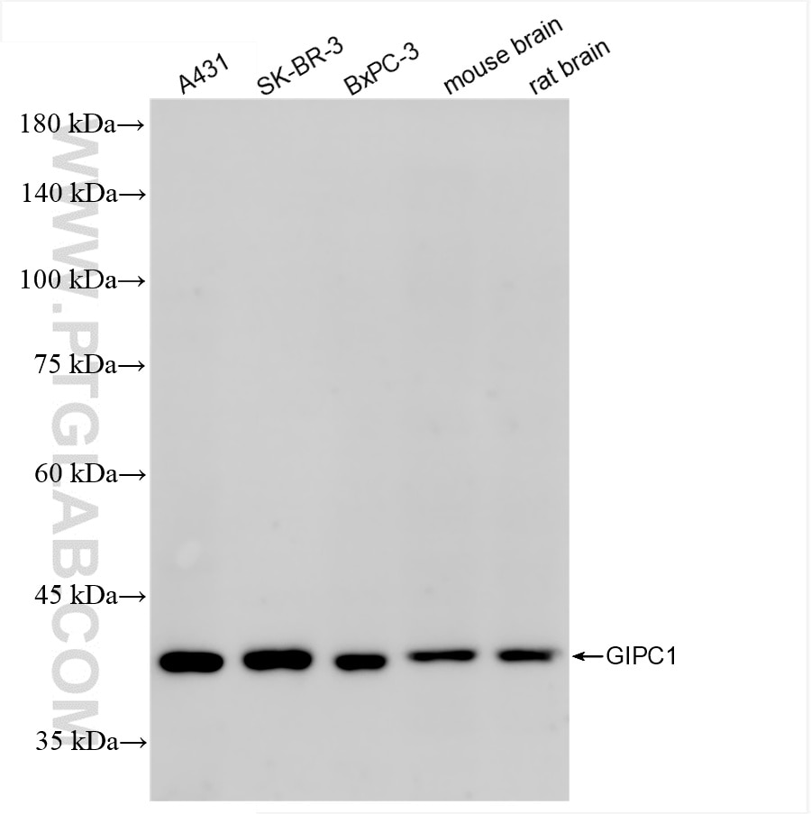 GIPC1