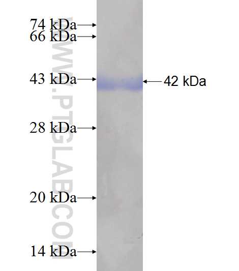 GIPC1 fusion protein Ag6597 SDS-PAGE