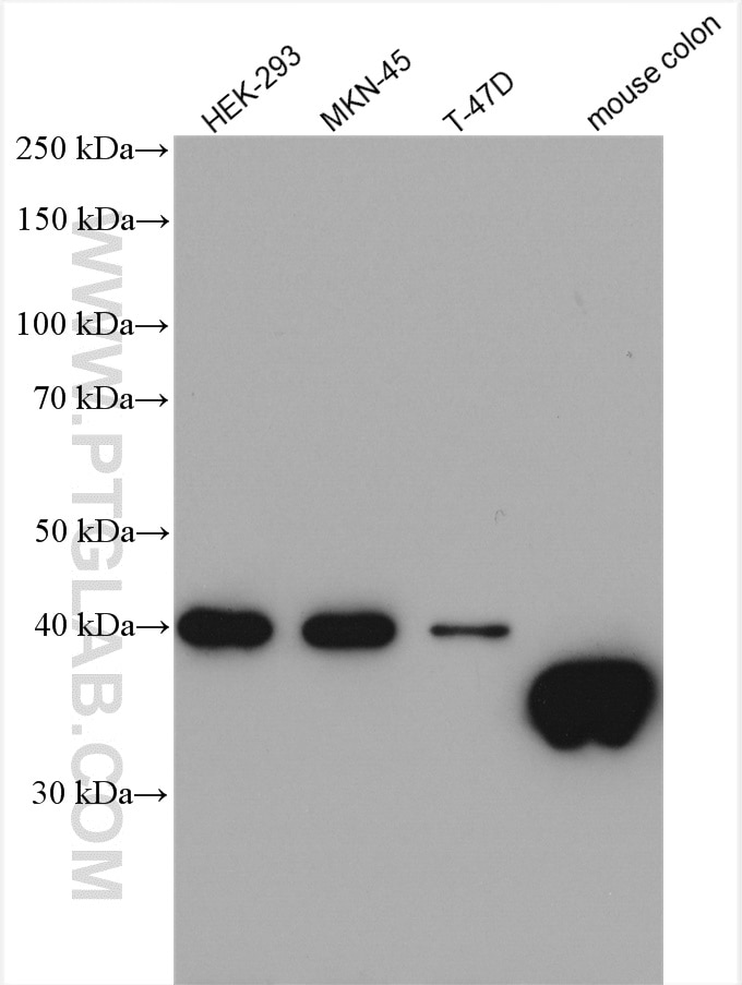Western Blot (WB) analysis of various lysates using GIPC2 Polyclonal antibody (12832-1-AP)