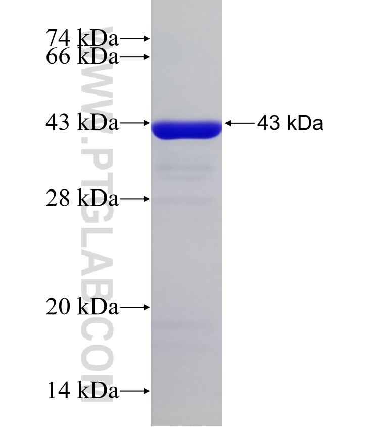 GIPC2 fusion protein Ag33213 SDS-PAGE GIPC2 fusion protein Ag33213 SDS-PAGE