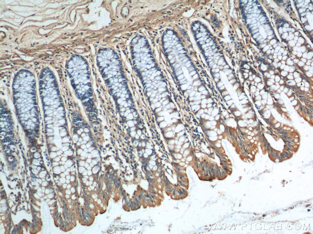 Immunohistochemistry (IHC) staining of human colon tissue using GIPR Polyclonal antibody (18230-1-AP)