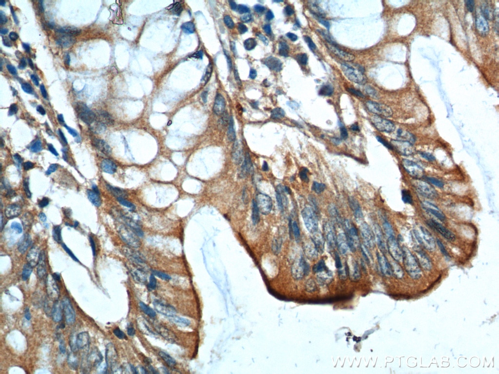 Immunohistochemistry (IHC) staining of human colon tissue using GIPR Polyclonal antibody (18230-1-AP)