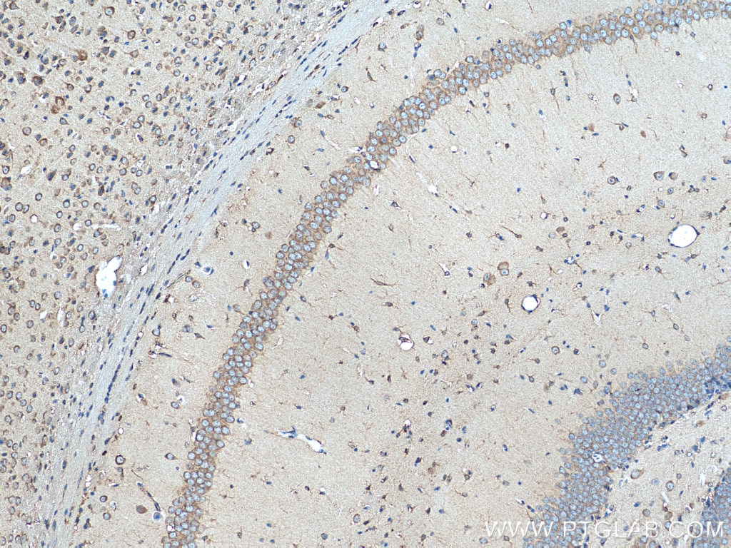 Immunohistochemistry (IHC) staining of mouse brain tissue using GIPR Polyclonal antibody (28322-1-AP)