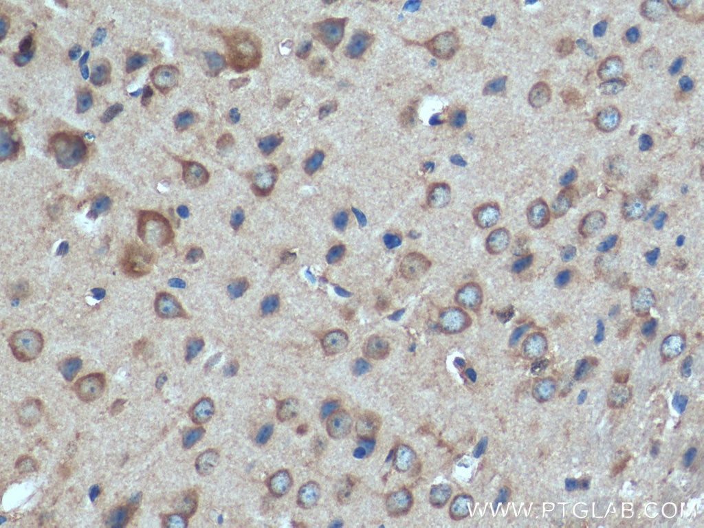 Immunohistochemistry (IHC) staining of mouse brain tissue using GIPR Polyclonal antibody (28322-1-AP)