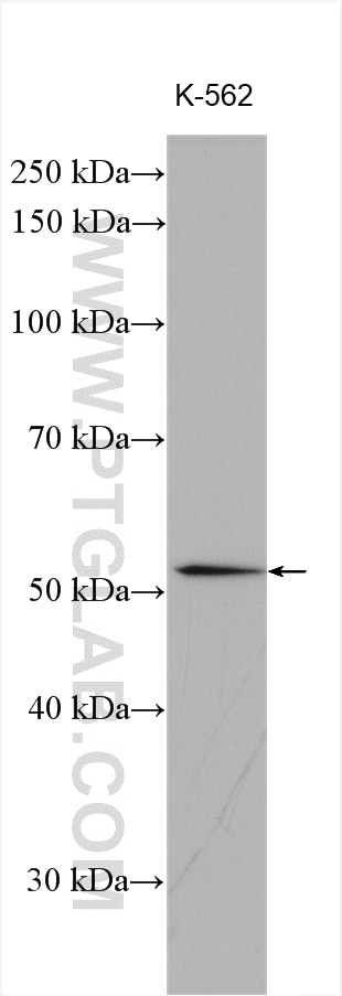 Western Blot (WB) analysis of various lysates using GIPR Polyclonal antibody (28322-1-AP)
