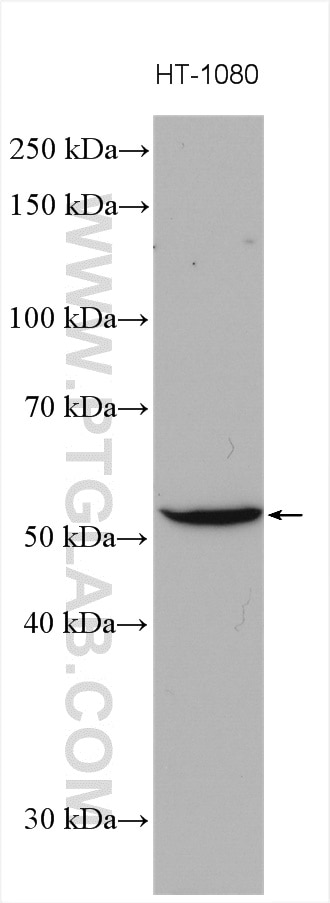 Western Blot (WB) analysis of various lysates using GIPR Polyclonal antibody (28322-1-AP)