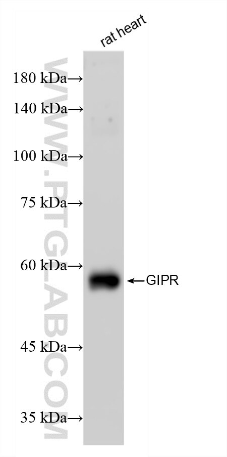 Western Blot (WB) analysis of various lysates using GIPR Recombinant monoclonal antibody (87123-1-RR)