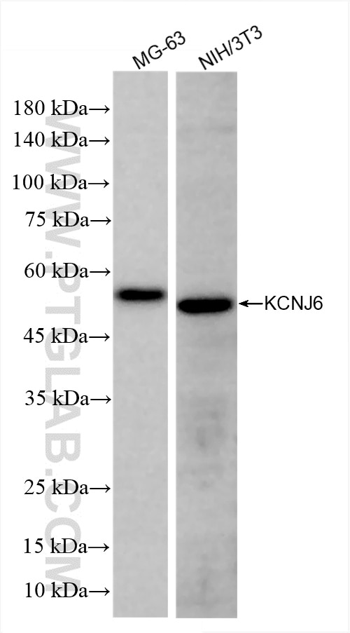 Western Blot (WB) analysis of various lysates using GIRK2 Recombinant antibody (86016-1-RR)