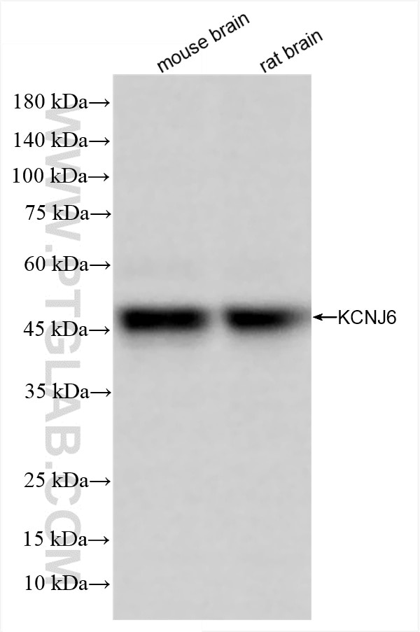 Western Blot (WB) analysis of various lysates using GIRK2 Recombinant antibody (86016-1-RR)