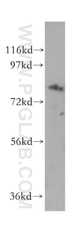 Western Blot (WB) analysis of mouse brain tissue using GIT1 Polyclonal antibody (16838-1-AP)