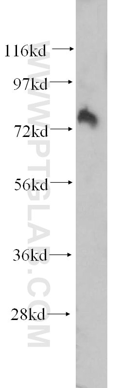 Western Blot (WB) analysis of mouse brain tissue using GIT1 Polyclonal antibody (16838-1-AP)