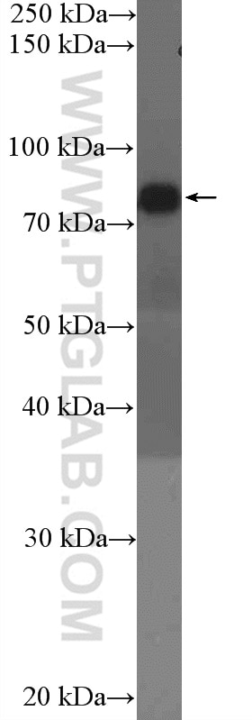 Western Blot (WB) analysis of ROS1728 cells using GIT1 Polyclonal antibody (26247-1-AP)