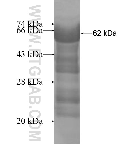 GIT1 fusion protein Ag10517 SDS-PAGE