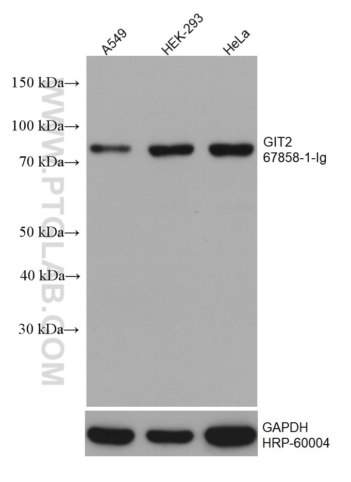 Western Blot (WB) analysis of various lysates using GIT2 Monoclonal antibody (67858-1-Ig)