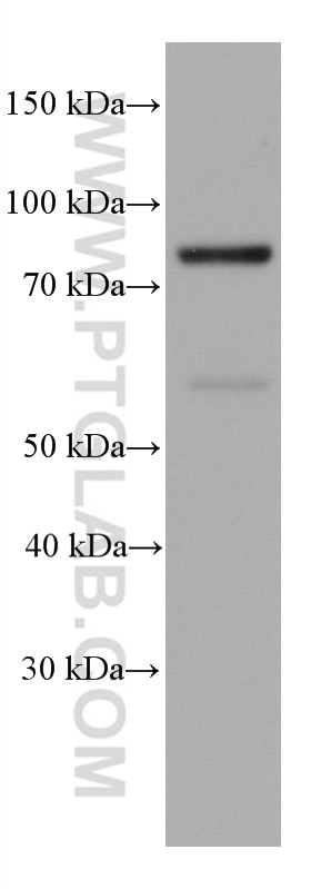Western Blot (WB) analysis of K-562 cells using GIT2 Monoclonal antibody (67858-1-Ig)