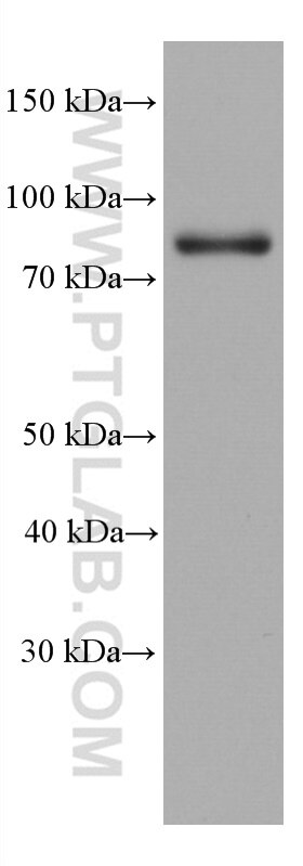 Western Blot (WB) analysis of HSC-T6 cells using GIT2 Monoclonal antibody (67858-1-Ig)