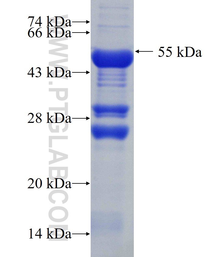 GIT2 fusion protein Ag0321 SDS-PAGE