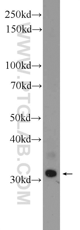 WB analysis of fetal human brain using 21158-1-AP