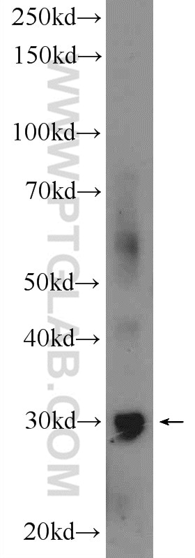 Western Blot (WB) analysis of mouse brain tissue using GIYD2 Polyclonal antibody (21158-1-AP)