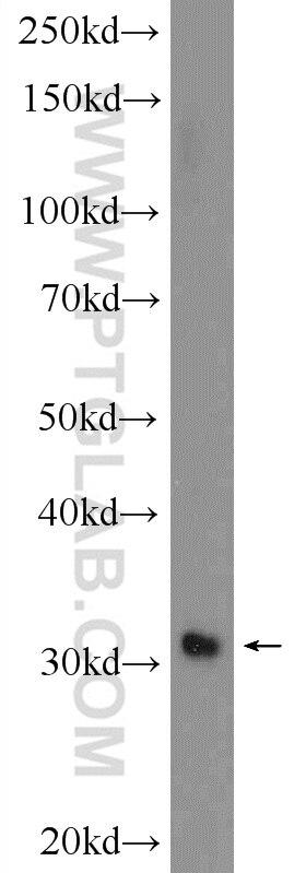 Western Blot (WB) analysis of fetal human brain tissue using GIYD2 Polyclonal antibody (21158-1-AP)