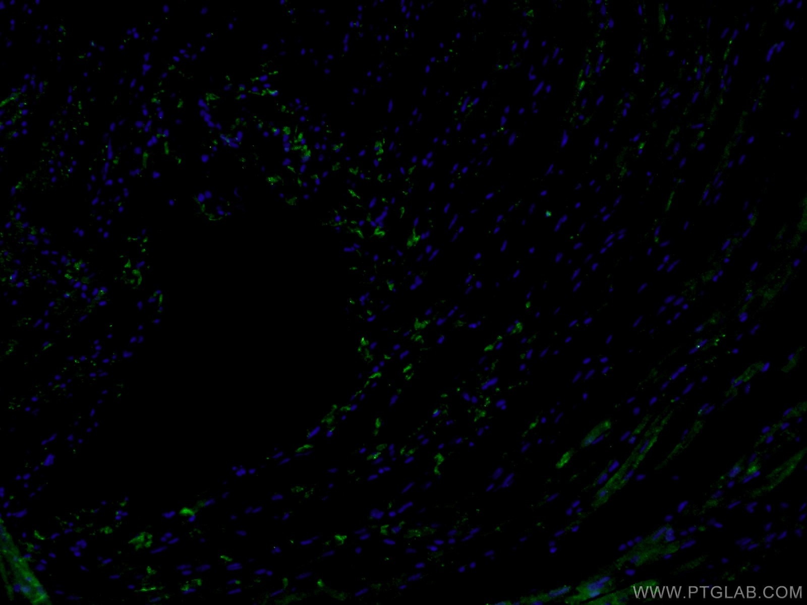 Immunofluorescence (IF) / fluorescent staining of mouse heart tissue using Connexin-43 Polyclonal antibody (15386-1-AP)