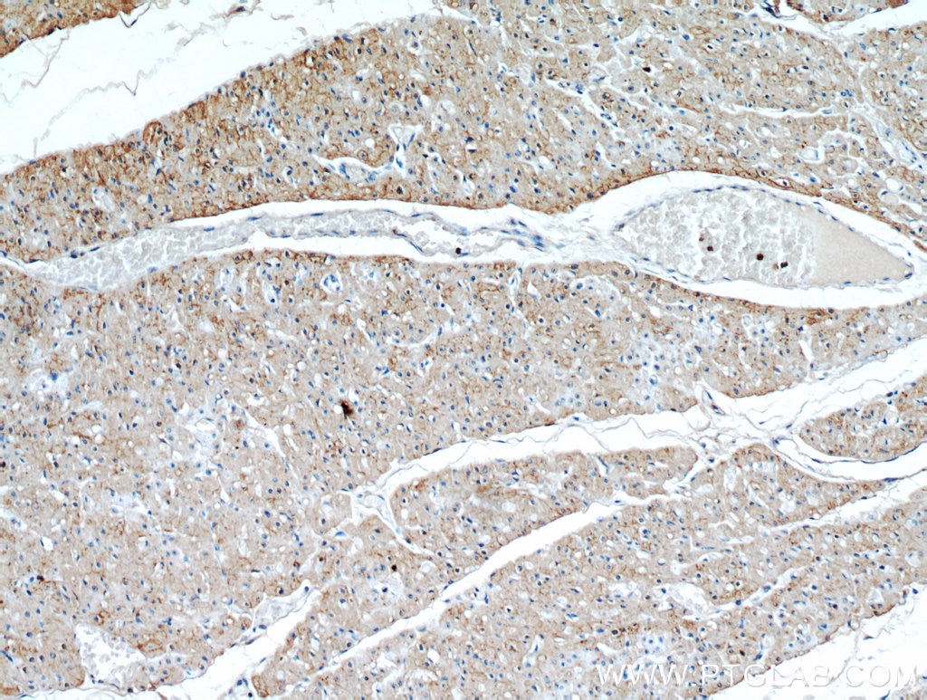 IHC staining of human heart using 15386-1-AP