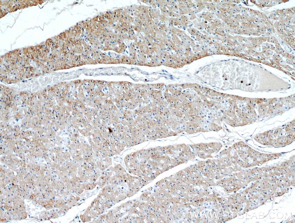 Immunohistochemistry (IHC) staining of human heart tissue using Connexin-43 Polyclonal antibody (15386-1-AP)