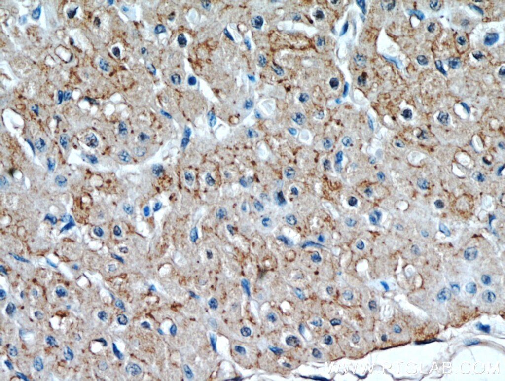 Immunohistochemistry (IHC) staining of human heart tissue using Connexin-43 Polyclonal antibody (15386-1-AP)